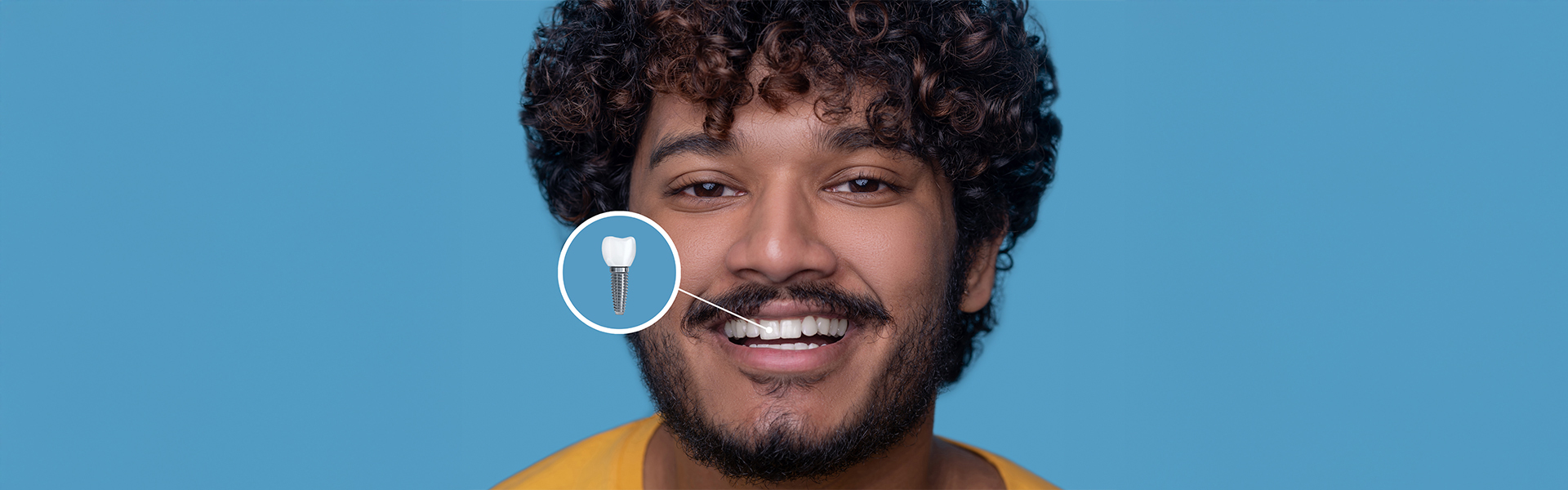 Dental Implants in Columbia, MO: Top Questions Answered by Experts